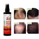 Dr Santé Spray anti hair loss 150ml